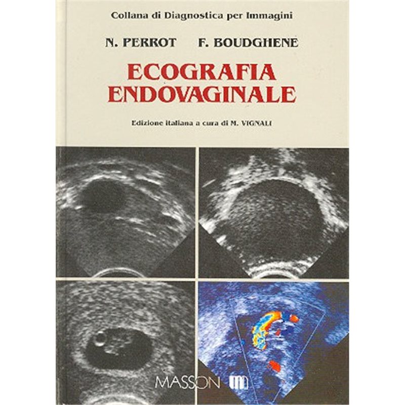 Ecografia endovaginale